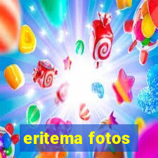 eritema fotos